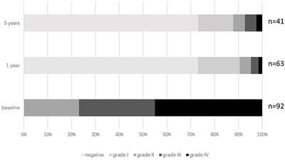 Transcatheter Patent Foramen Ovale Closure Is Effective in Alleviating Migraine in a 5-Year Follow-Up